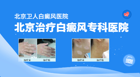 北京治疗白癜风专科医院.jpg