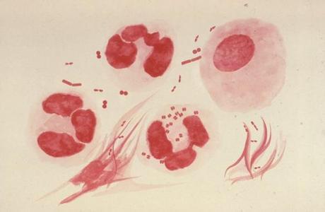脑膜炎奈瑟菌画图图片