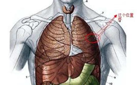 胸肋软骨炎疼痛位置图图片