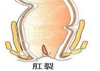 <a href=