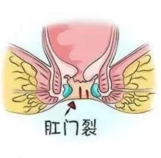 <a href=