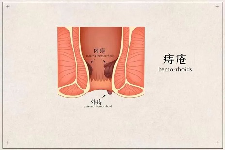 <a href=