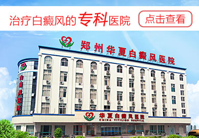 郑州白癜风医院