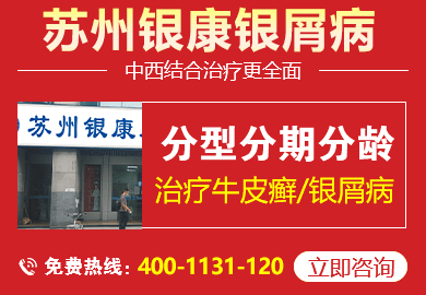 常州牛皮癣医院