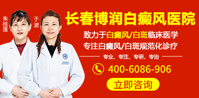 长春白癜风医院