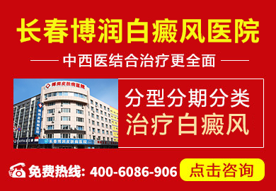德惠市白癜风医院
