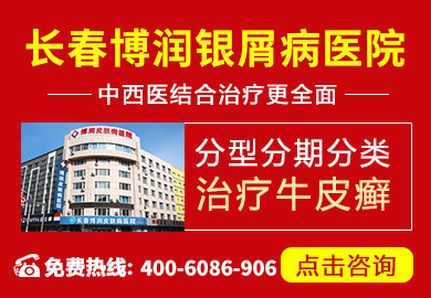 公主岭市银屑病医院
