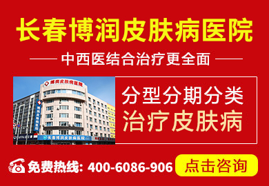 榆树市皮肤病医院