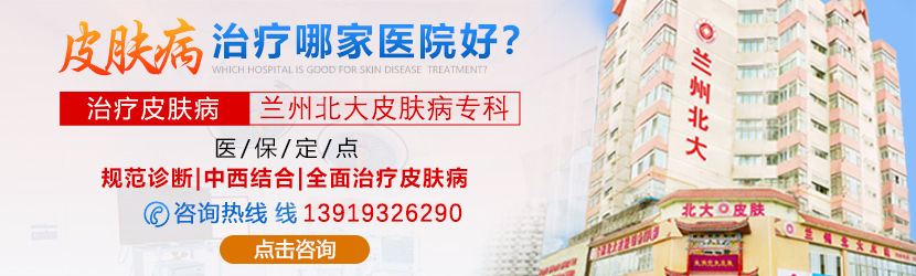 兰州皮肤病医院哪个比较好